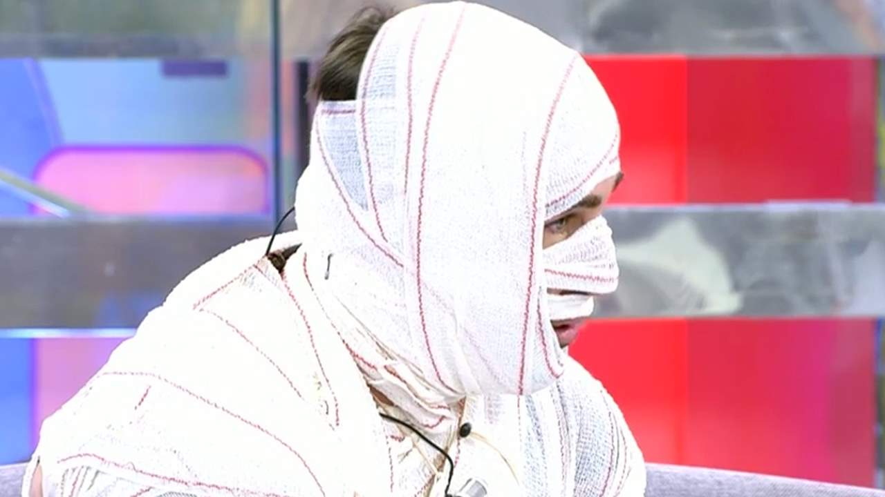 Rafa Mora, vendado como una momia, muestra el resultado de su último retoque estético en 'Sálvame'