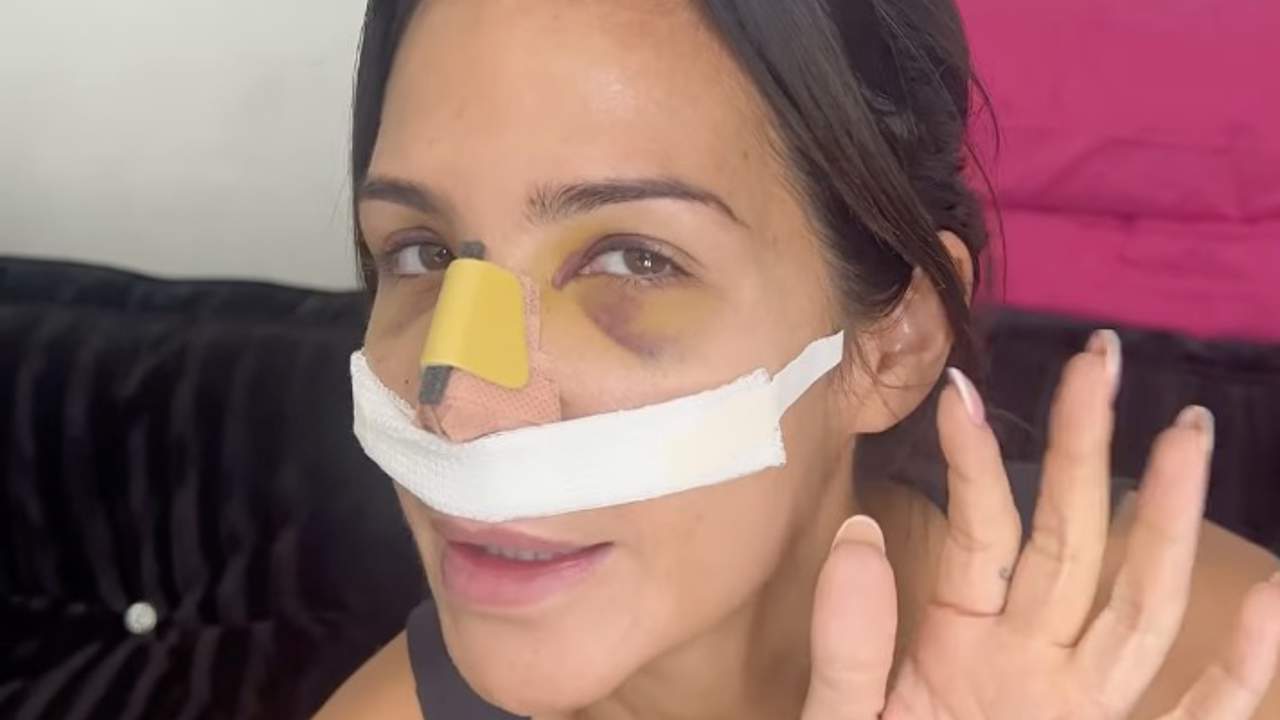 Tamara Gorro enseña su nuevo rostro solo 8 días después de operarse