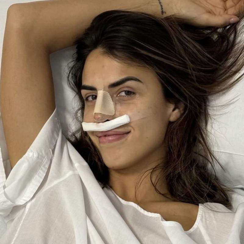 Antes y después: Sofía Suescun enseña el resultado final de su operación de nariz
