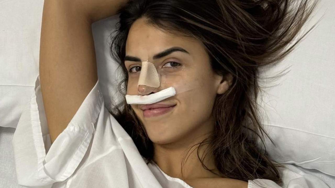 Antes y después: Sofía Suescun enseña el resultado final de su operación de nariz
