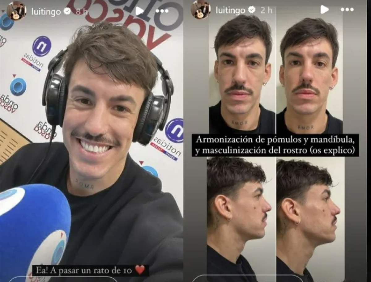 Luitingo 
