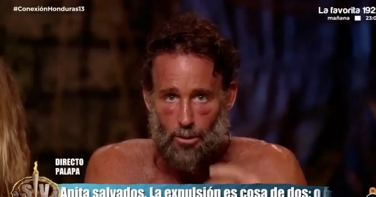 Escassi